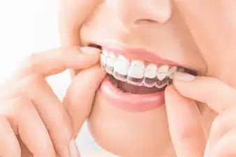 Transform your smile with Invisalign Invisible Braces